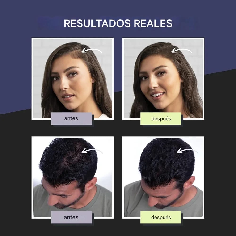 Cabello lleno al instante con TOPPIK
